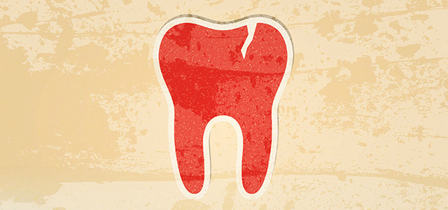 cracked tooth