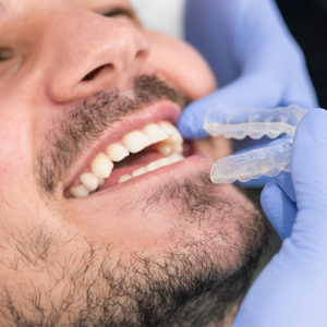 Cosmetic Dentistry Teeth Straightening